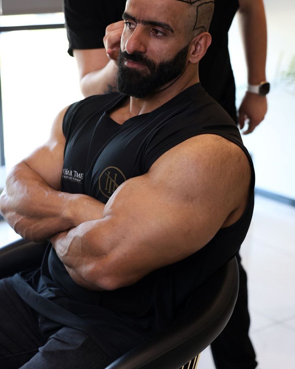 عکسهای هادی چوپان پس از کاشت مو خبرساز شد