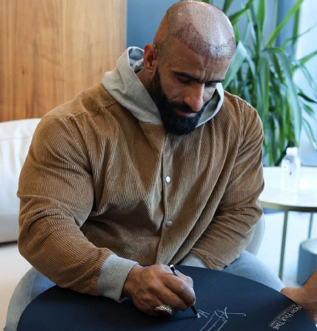 عکسهای هادی چوپان پس از کاشت مو خبرساز شد