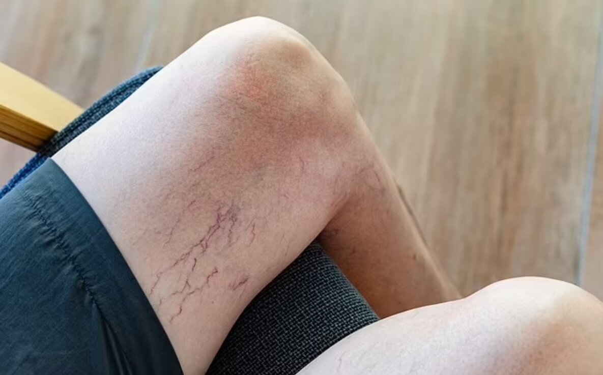 این علامت روی پوست از مرگ زودرس خبر میدهد