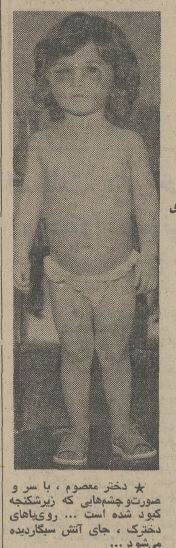 پدر و مادر شیرازی که دختر ۳ساله را شکنجه میکردند، بازداشت شدند +عکس