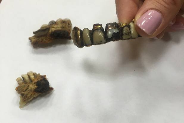 دندانهای آدولف هیتلر به نمایش گذاشته شد! +عکس