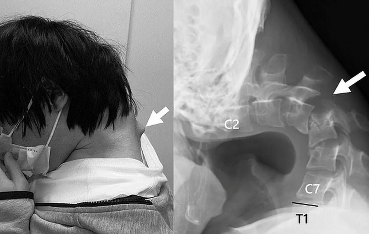 گردن جوان ژاپنی