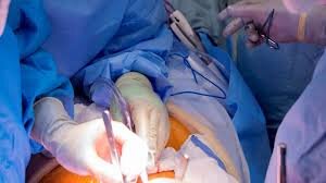 زمان طلایی این تصمیم مهم را از دست ندهید