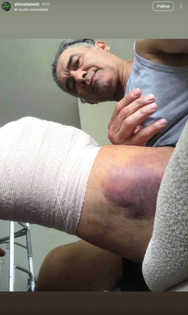 وضعیت دردناک احمدرضا عابدزاده در آمریکا +عکس