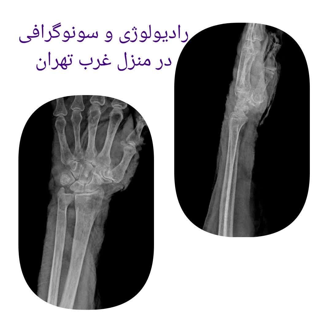 سونوگرافی در منزل تهران