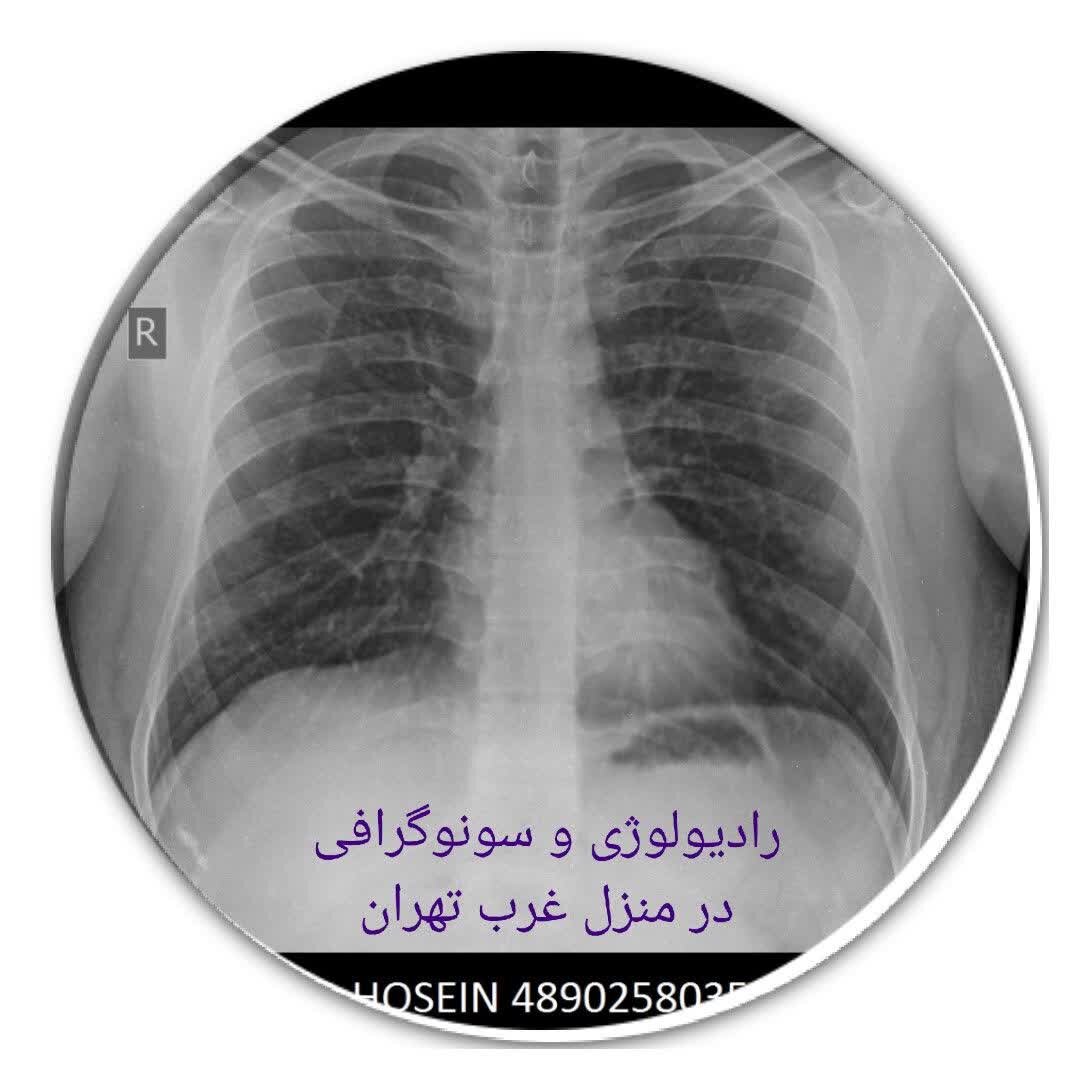 رادیولوژی و سنوگرافی در منزل تهران