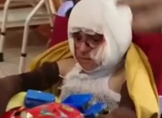 شرایط دردناک کودکی که تمام خانواده‌اش را در جنگ از دست داد +ویدیو