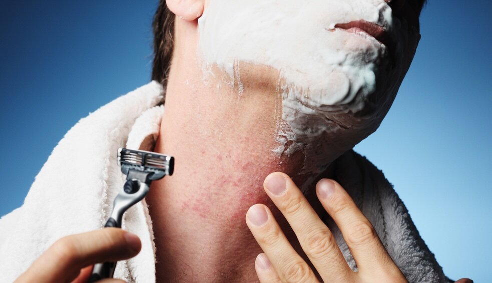تحریک، قرمزی و جوش در اثر استفاده از تیغ