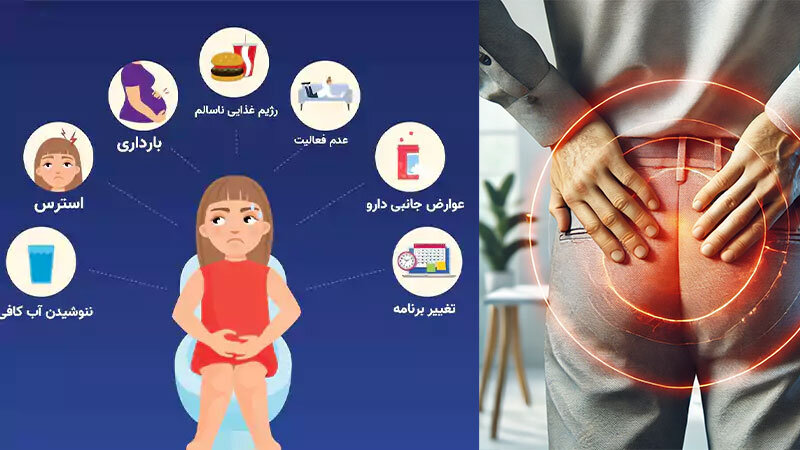 علت شقاق مقعدی