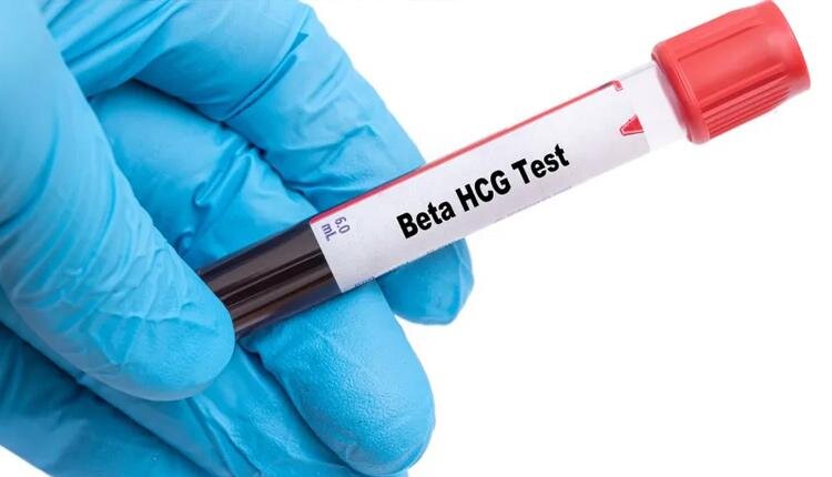 معرفی آزمایش خون بارداری