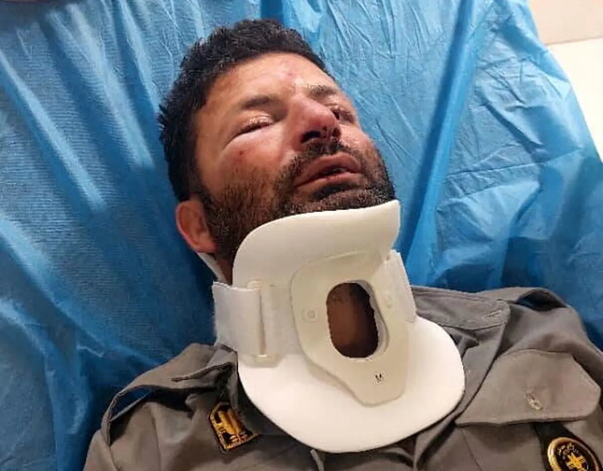 حمله بی‌رحمانه ۳ نفر به مامور قانون؛ یک محیط‌بان به جرم حفاظت از طبیعت تا پای مرگ رفت +عکس