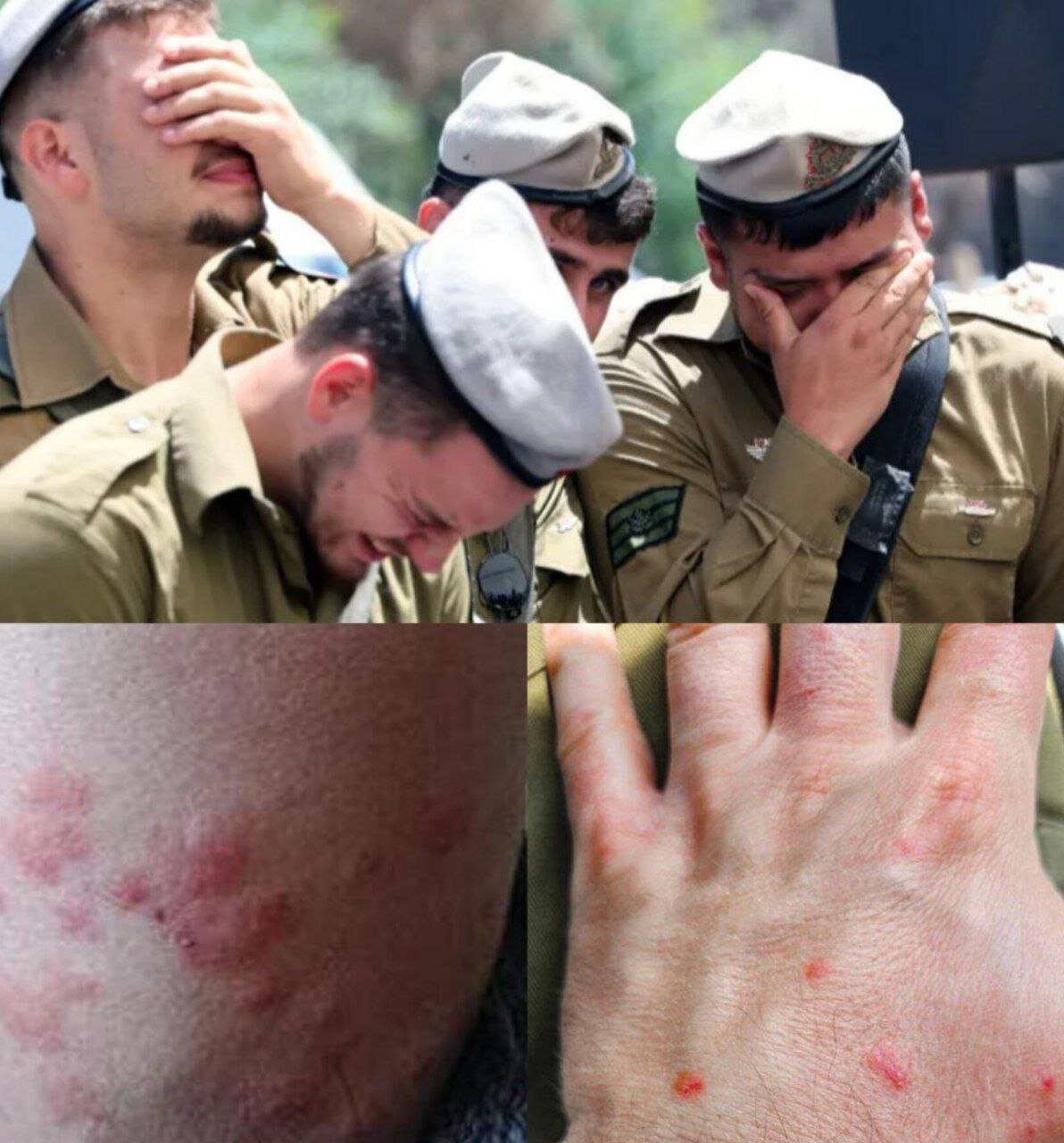 ساس‌ها در غزه به جان نظامیان اسرائیلی افتادند +عکس