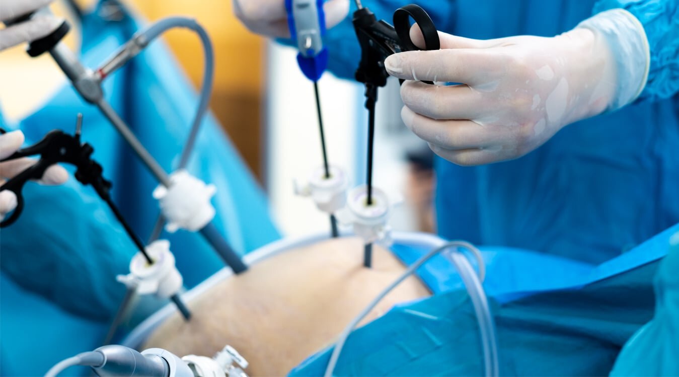 چربی شکم و پهلو