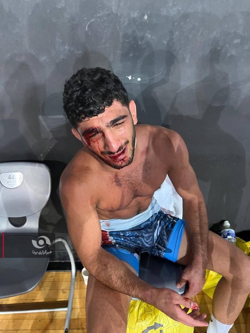 تصاویر دردناک دانیال سهرابی فضای مجازی را به هم ریخت +عکس