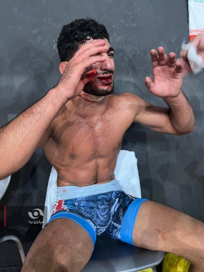 تصاویر دردناک دانیال سهرابی فضای مجازی را به هم ریخت +عکس