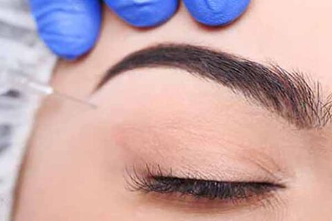 لیفت و بالا بردن ابرو با تزریق ژل امکان دارد؟