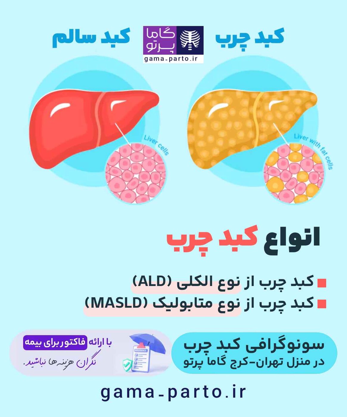 انواع کبد چرب