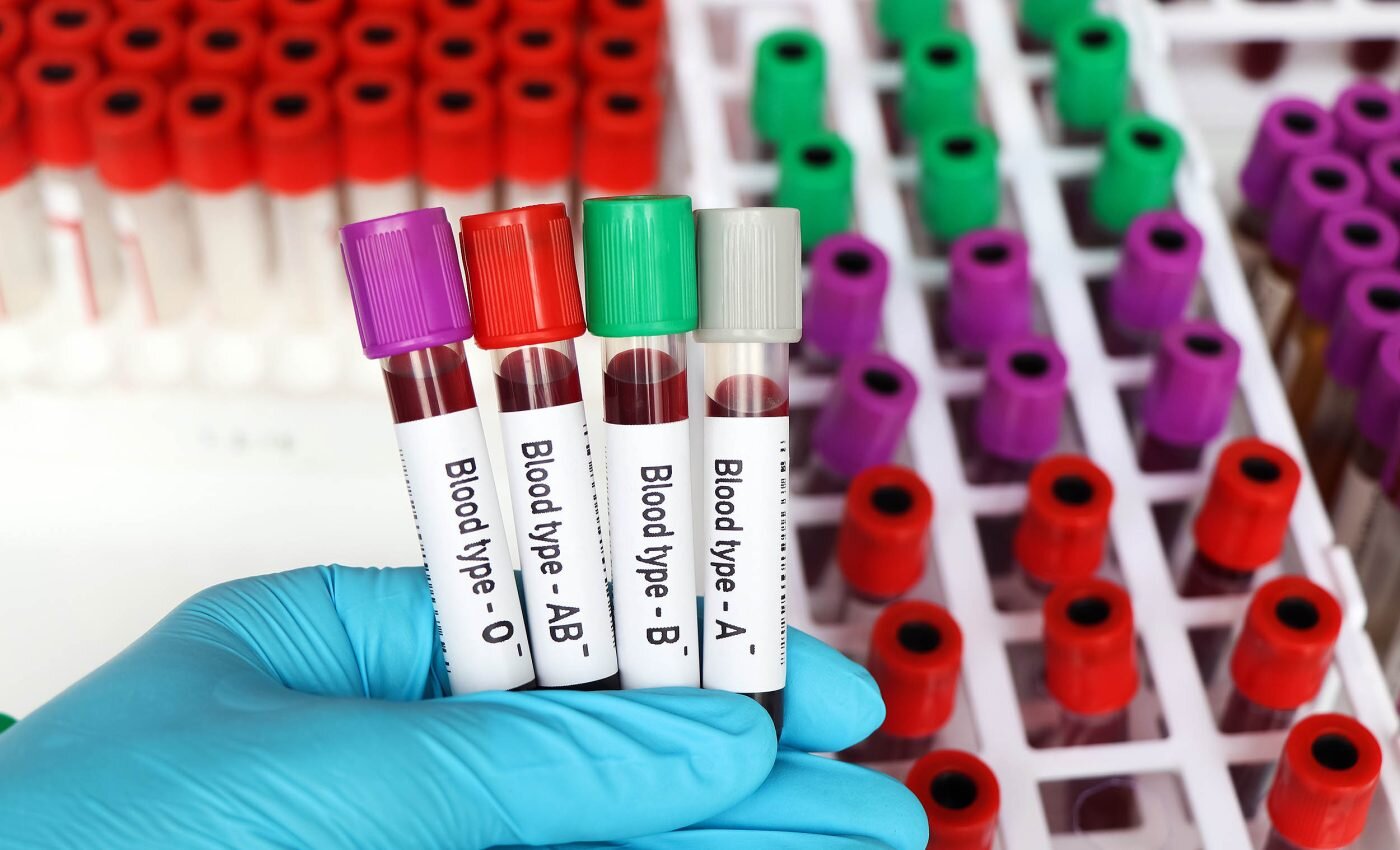 خطر سکته مغزی افراد دارای این گروه خونی را تهدید میکند