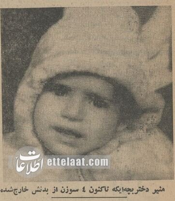 ۱۴ سوزن در بدن دختر ۲ ساله، شکنجههای نامادری سنگدل رسانهای شد! +عکس