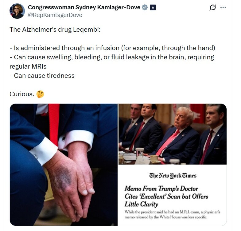 افشاگری نماینده مجلس درباره بیماری خطرناک آقای رئیسجمهور! +عکس