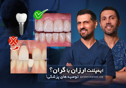 ایمپلنت ارزان یا گران؟ پشت‌پرده تفاوت قیمت ایمپلنت‌ها از نگاه متخصصان