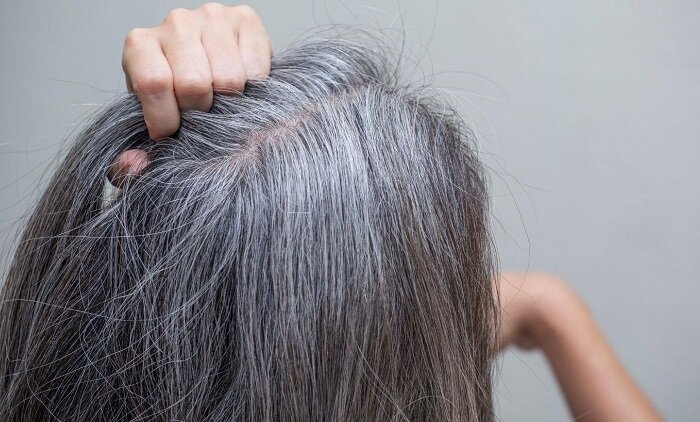راهکاری برای جلوگیری از سفیدی مو وجود دارد؟