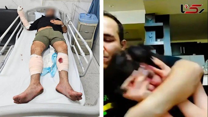 شکنجهگر اینستاگرامی زنان با شلیک گلوله پلیس زمینگیر شد