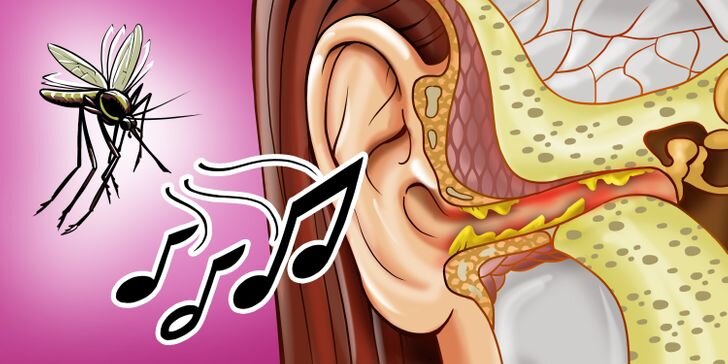 چرا پشه‌ها کنار گوشمان وزوز می‌کنند؟