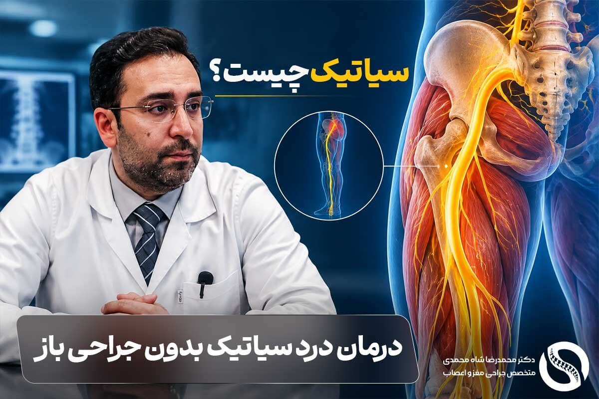 سیاتیک چیست و چه علائمی دارد؟ توضیحات دکتر محمدرضا شاه محمدی برای درمان درد سیاتیک بدون جراحی باز