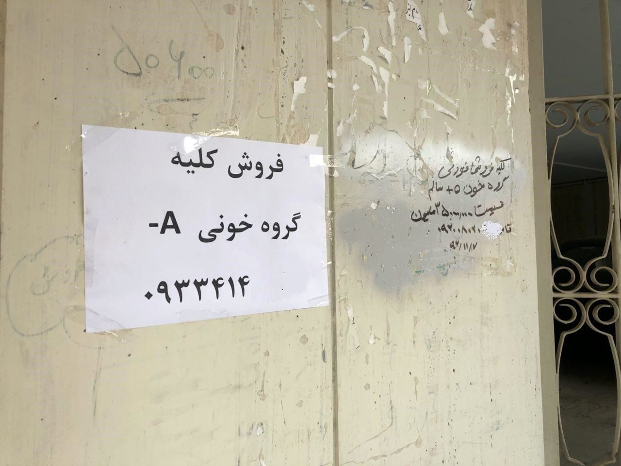 فروش دلاری اعضای بدن ایرانی‌ها در کشورهای منطقه/ کلیه ۷ تا ۱۵ هزار دلار!